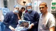 اشیاء عجیب در معدۀ زن مصری +تصاویر