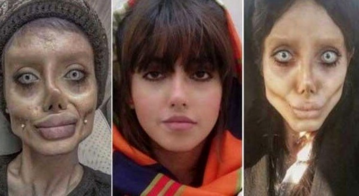 ابتلای سحر تبر به کرونا