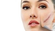 محوکردن جای زخم و بخیه با این چای