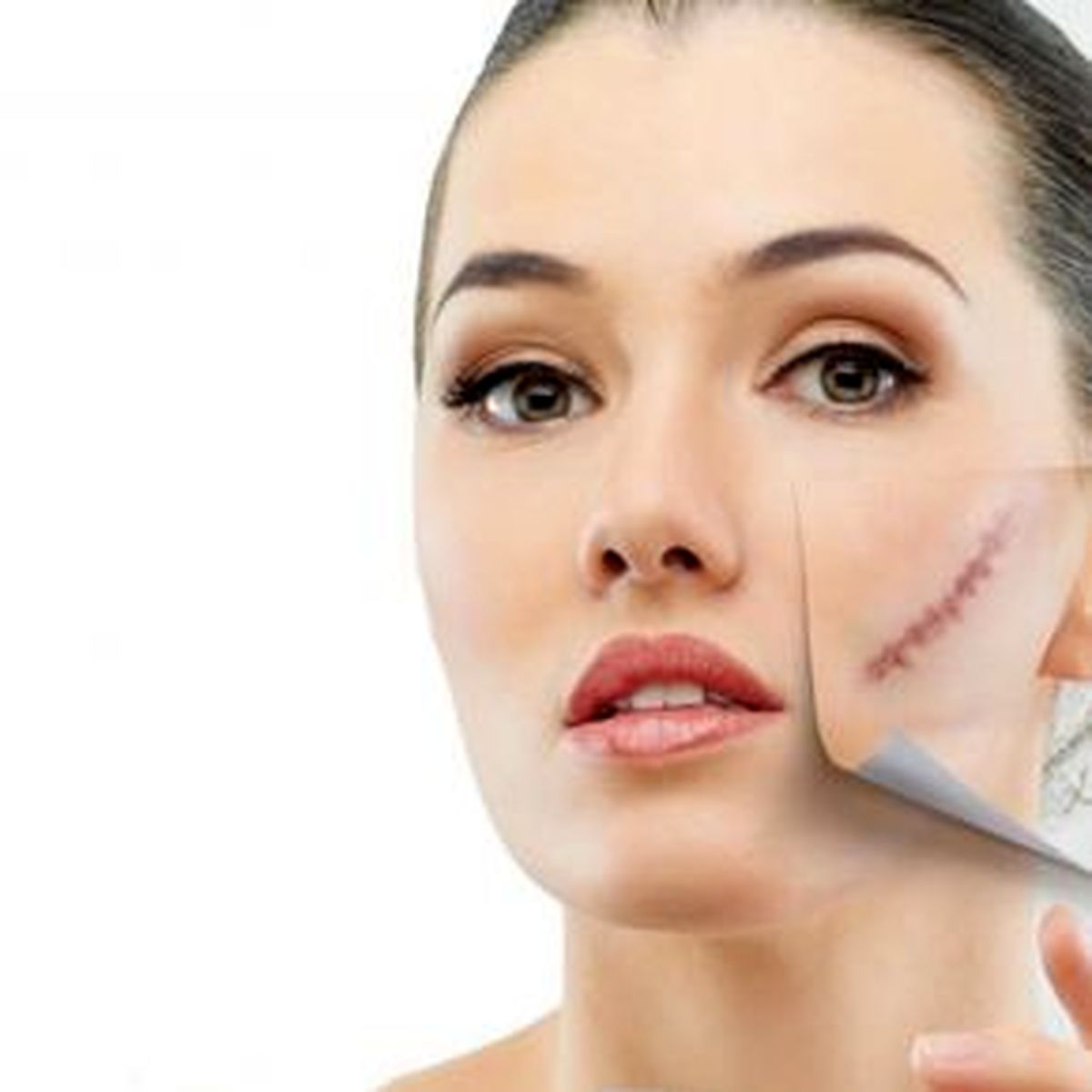 محوکردن جای زخم و بخیه با این چای