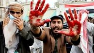 افزایش شمار کشته‌های جنگ یمن به حدود 10 هزار نفر