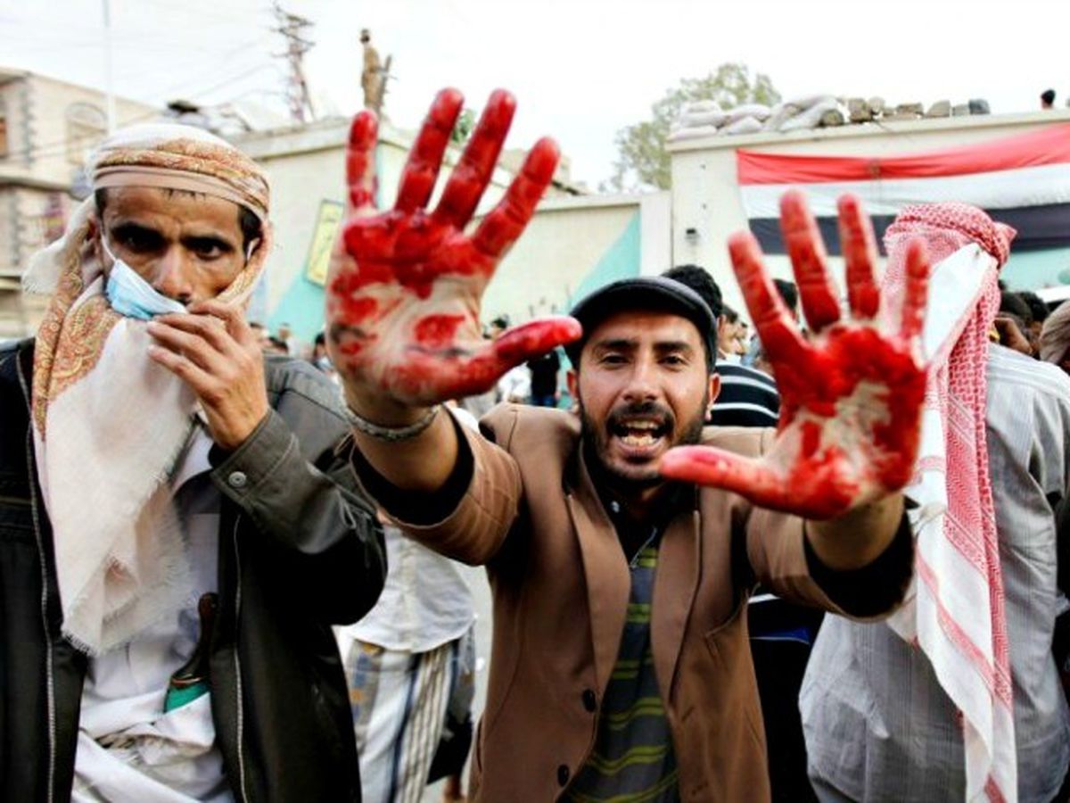 افزایش شمار کشته‌های جنگ یمن به حدود 10 هزار نفر