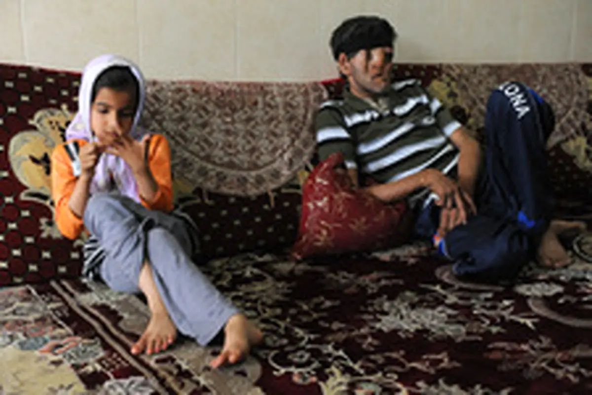 آغاز درمان «شیخ» با ساخت پروتزهای جمجمه و صورت