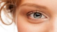 پف زیر چشم را چگونه برطرف کنیم؟