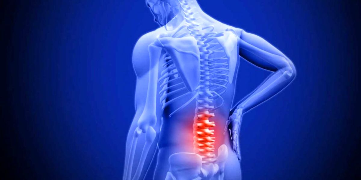 علت ایجاد دیسک کمر چیست؟+راه های درمان و پیشگیری از دیسک کمر
