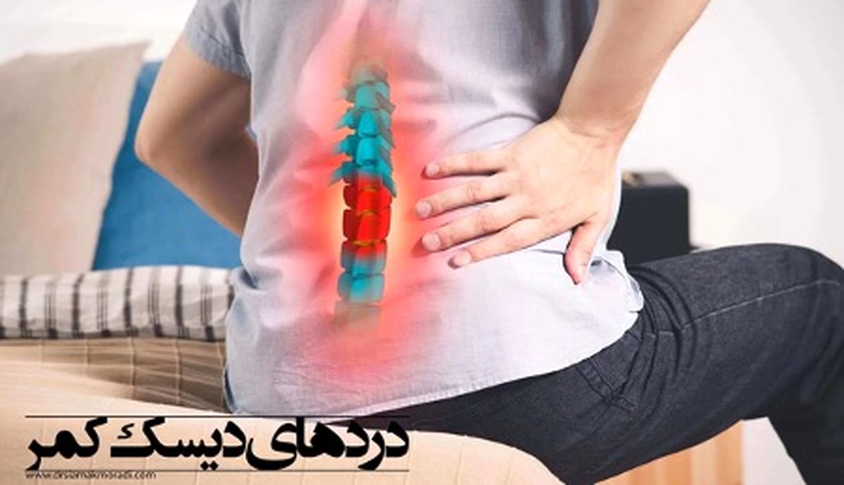 بهترین درمان بدون جراحی برای دیسک کمر