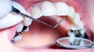ماجرای فوت دریا دلکش ۱۲ ساله با عمل دندانپزشکی 