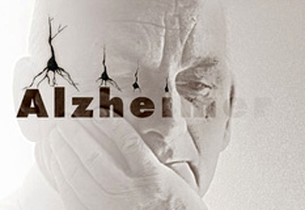 ابتلای بیش از ۵۰۰ هزار نفر به آلزایمر