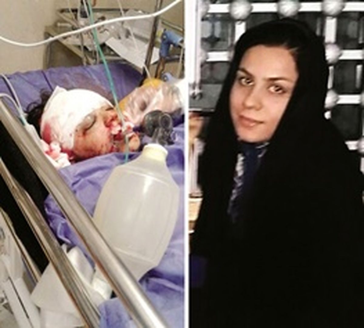  مادرشوهر بخاطر اختلاف با عروسش با ساطور به‌جان او افتاد/ اعضای بدن مقتول اهداء می‌شود + عکس