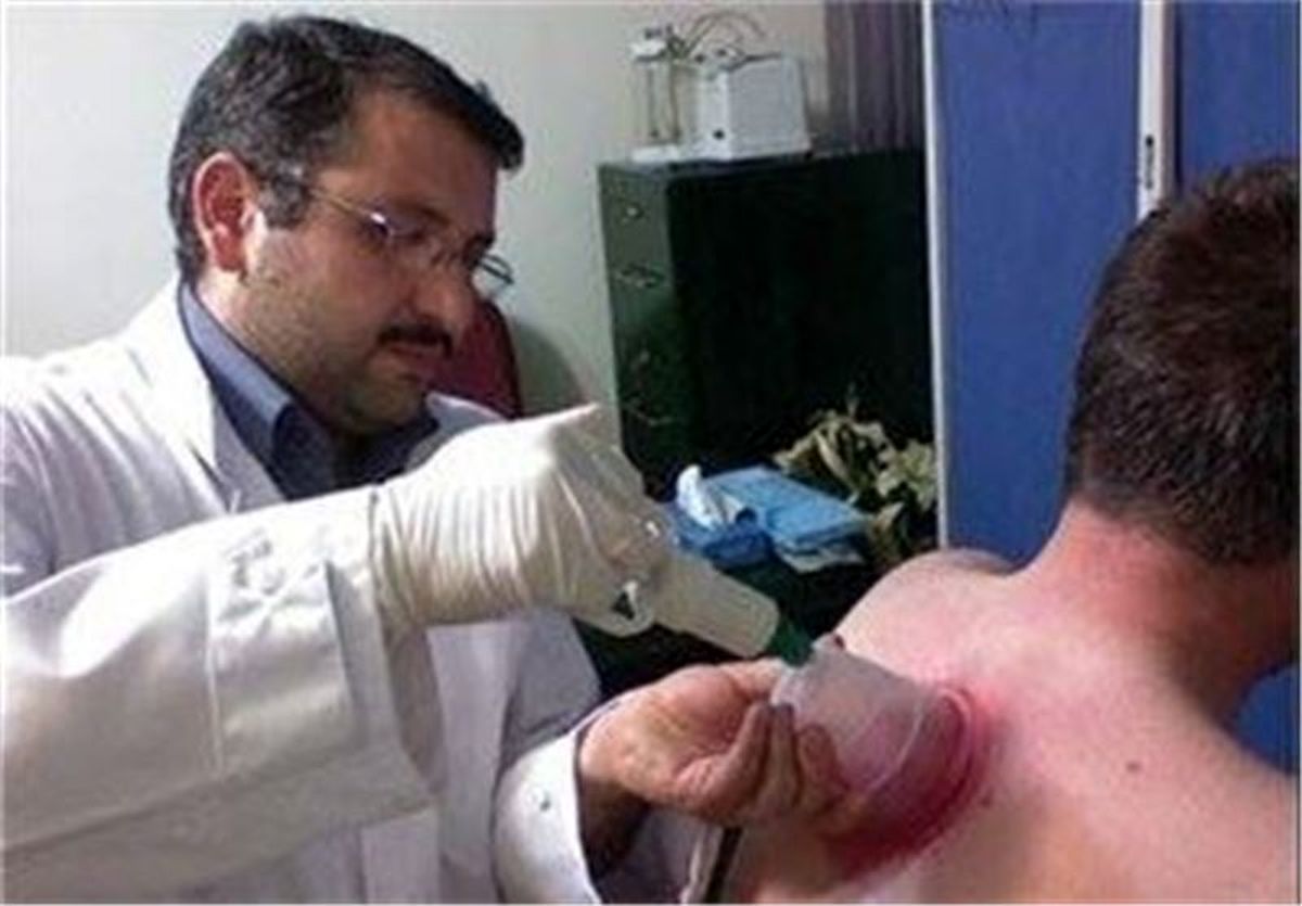  اثرات درمانی حجامت در درمان بیماری‌ها 