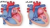 ساخت دریچه‌ مصنوعی قلب با قابلیت خود ترمیمی
