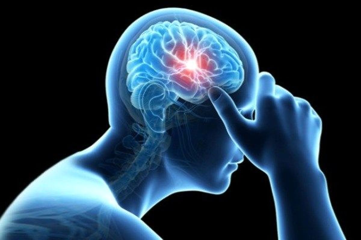 سکته مغزی در مردان چه علائمی دارد؟