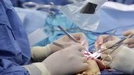 پیوند دست قطع‌شده کودک ۱۳ماهه 