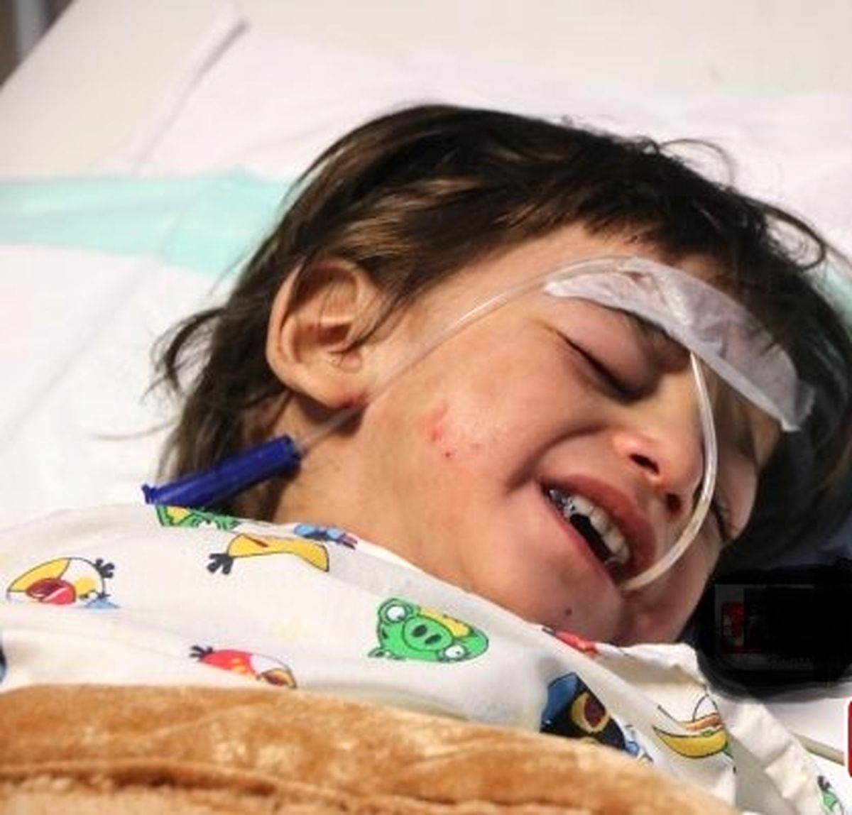 ضرب و شتم کودک 2 ساله توسط ناپدری