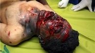 ۱۹ مصدوم چهارشنبه سوری در کل کشور