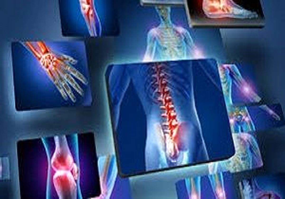 6 خوراکی برای ضربه فنی کردن درد مفاصل شما