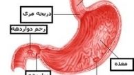 بدون دارو زخم معده و اثنی عشر را درمان کنید