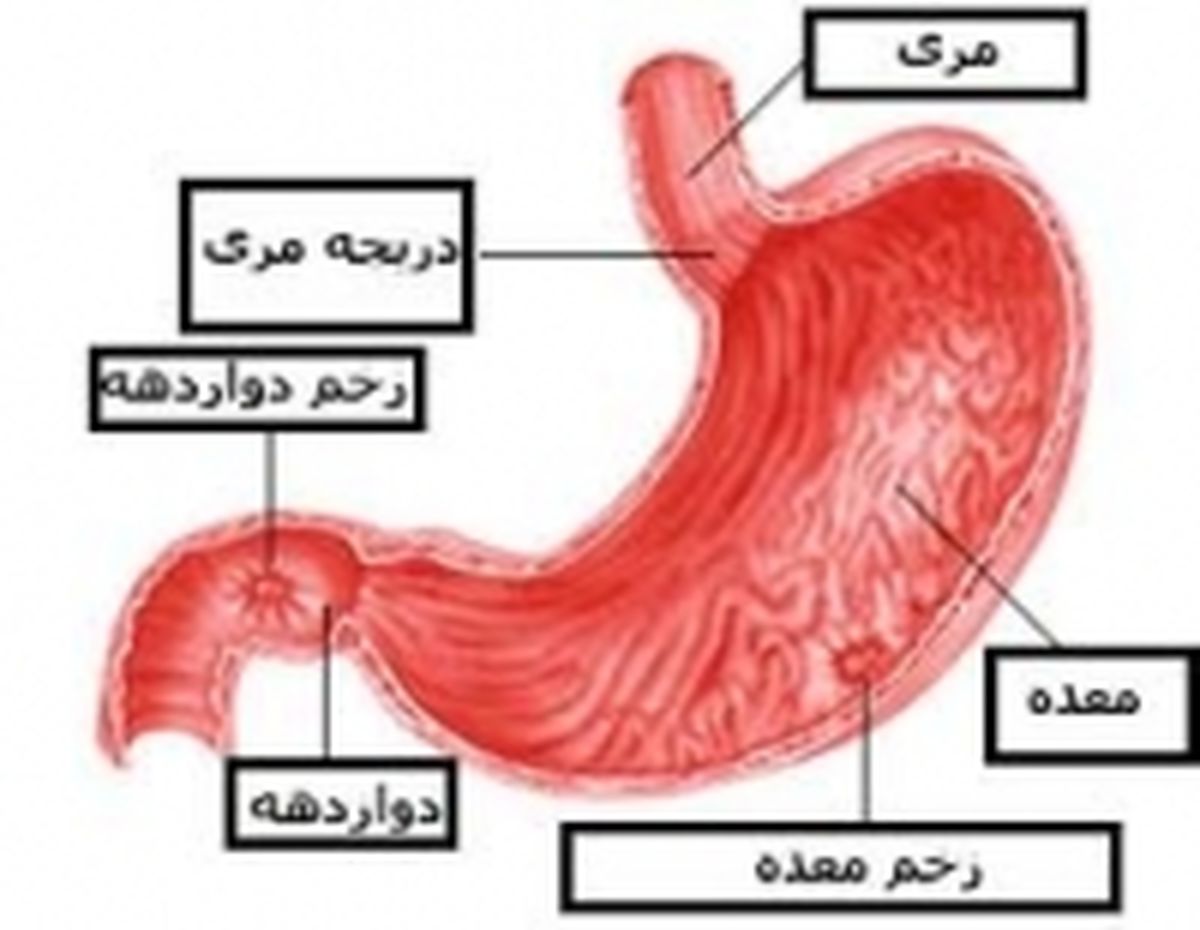 بدون دارو زخم معده و اثنی عشر را درمان کنید