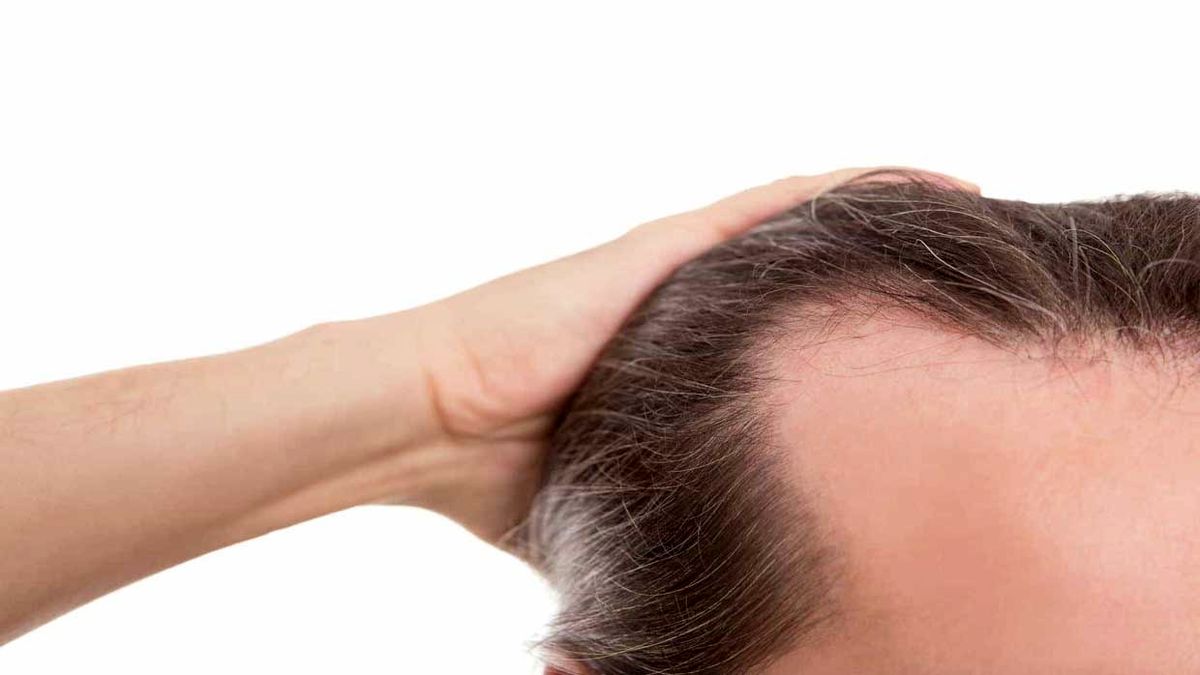 راهکارهای پرپشتی موی آقایان