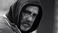 صورت مجید مظفری آسیب دید + عکس