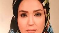 جشن تولد «زهره فکور صبور» با چهره جدیدش
