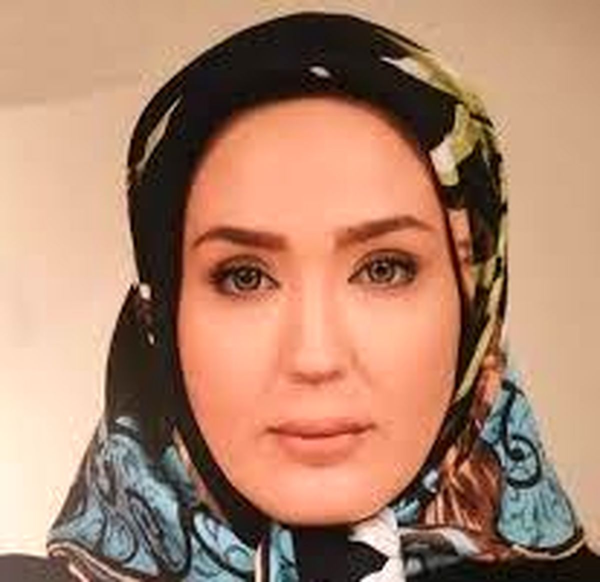 جشن تولد «زهره فکور صبور» با چهره جدیدش
