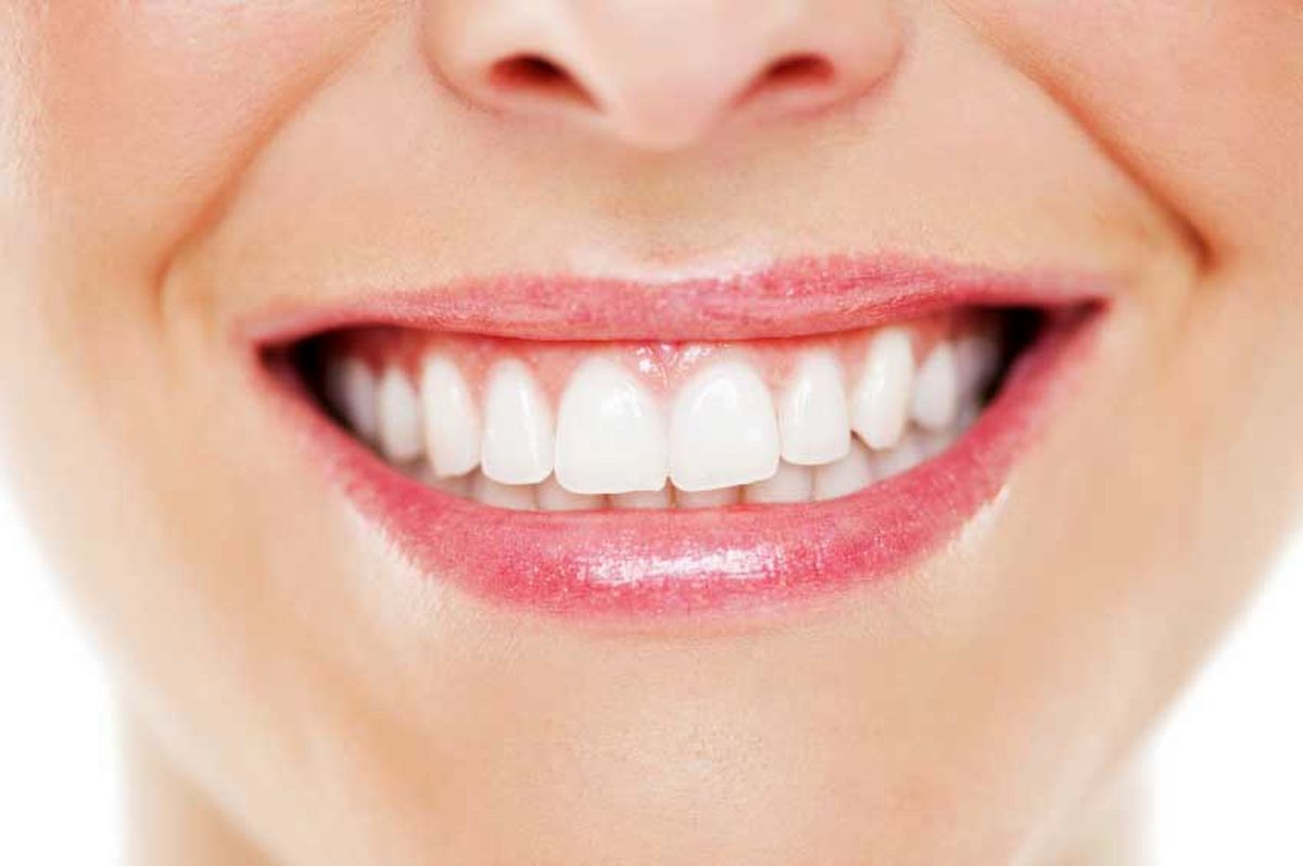 بهترین سفید کننده دندان خانگی چیست؟