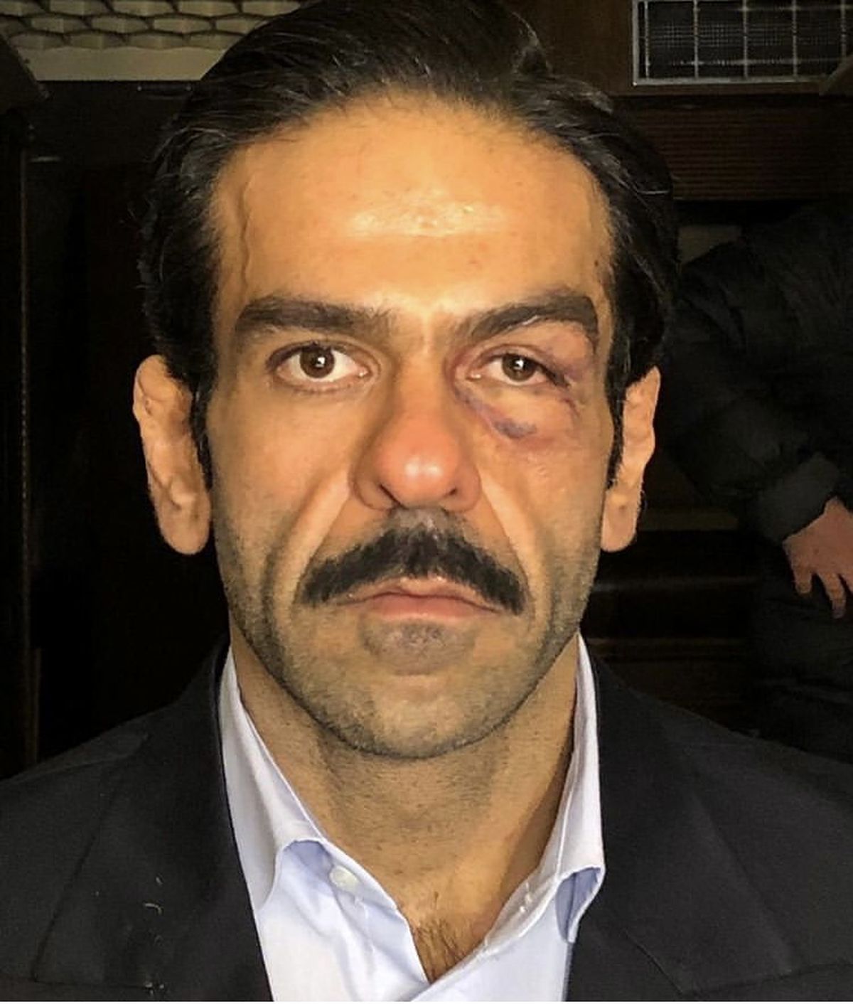 صورت گریم‌ شده بازیگر فیلم ‌تختی + عکس