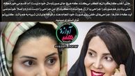 توضیح خانم بازیگر در مورد عمل زیبایی اش+عکس