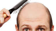 ریزش موهای چرب را چگونه درمان کنیم؟