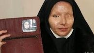 ابهام در ختم پرونده قربانیان اسیدپاشی اصفهان