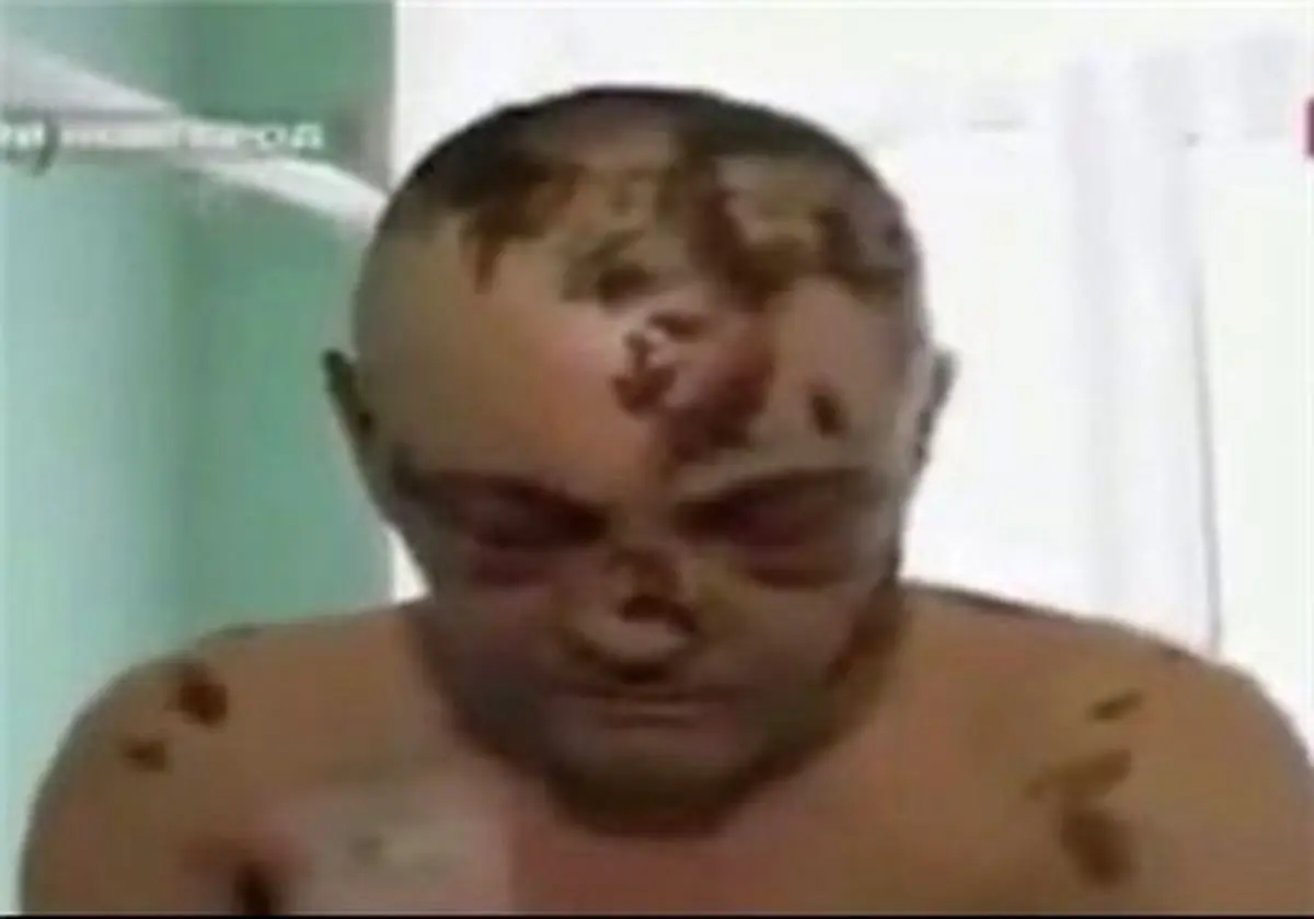 ماده مخدر گوشتخوار موسوم به" کروکودیل"