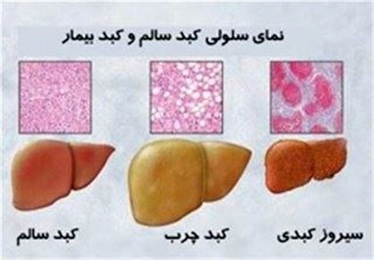 نوشیدن آب سرد هنگام ناشتا و پس از حمام برای کبد مضر است