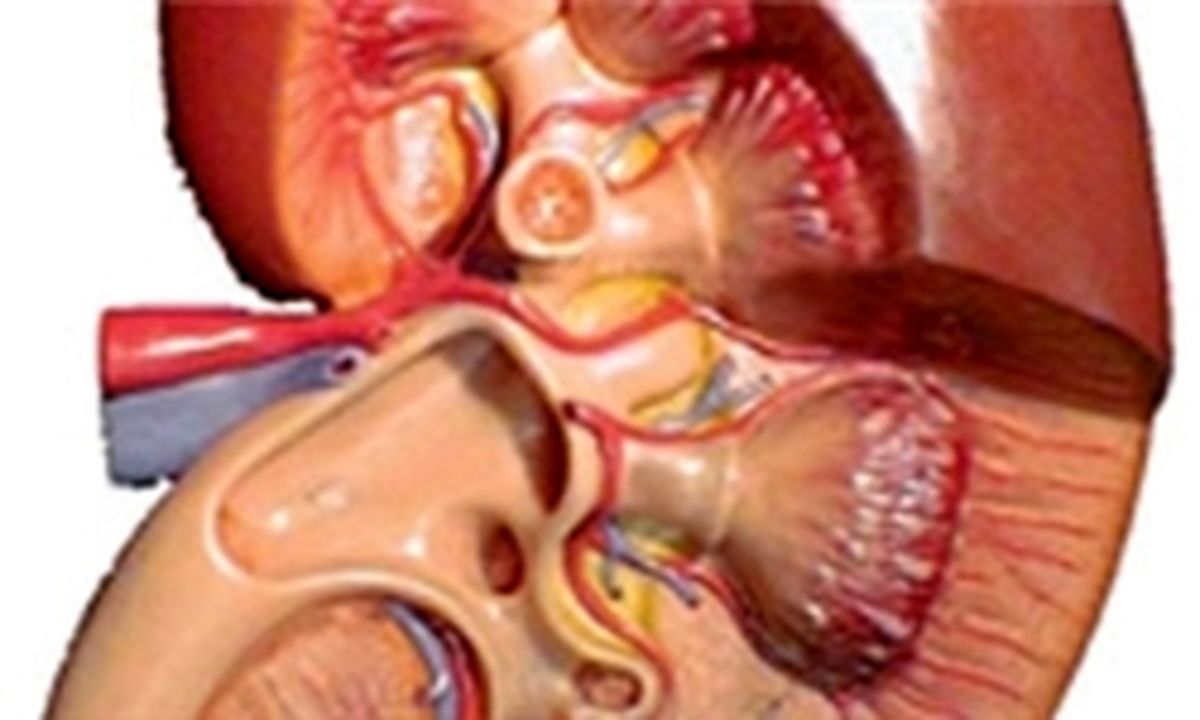 تغییر در رنگ ادرار را جدی بگیرید/ آب به میزان کافی بنوشید