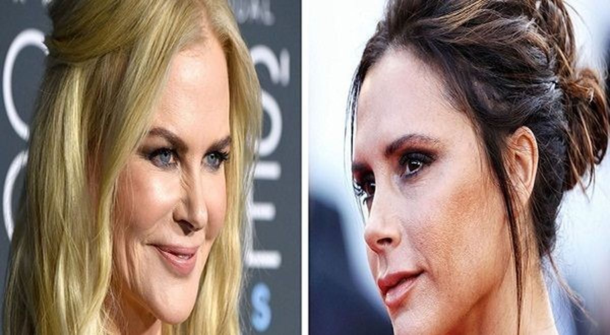 سلبریتی های زن خارجی که به عمل های زیبایی خود اعتراف کردند +تصاویر