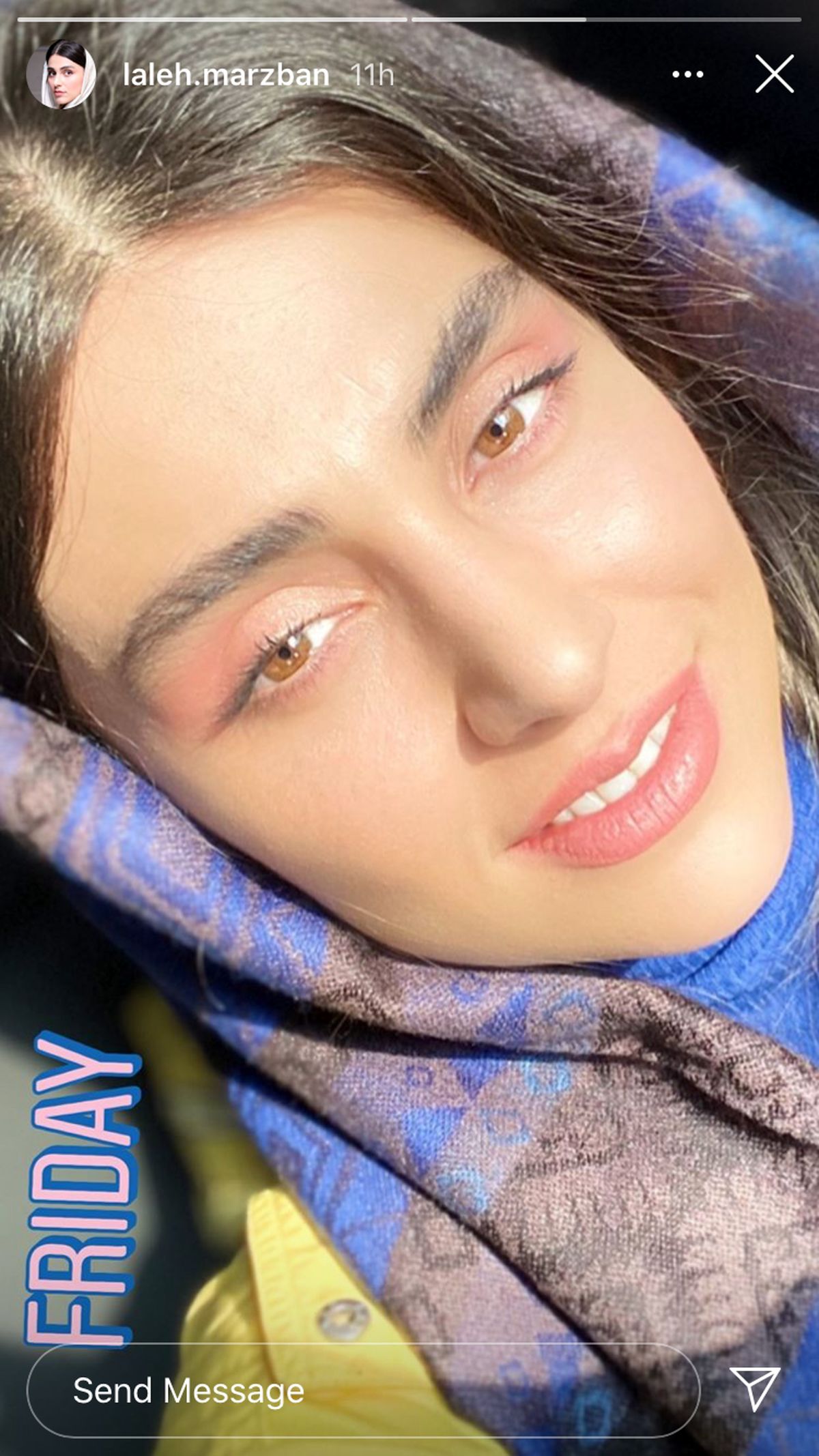 ظاهر جدید لاله مرزبان + عکس