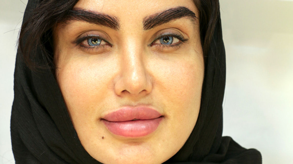 مراحل عمل تغییر رنگ چشم: از مشاوره تا نتیجه