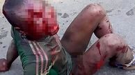 آتش زدن وحشیانه نوجوان 15 ساله به دلیل سرقت + تصاویر