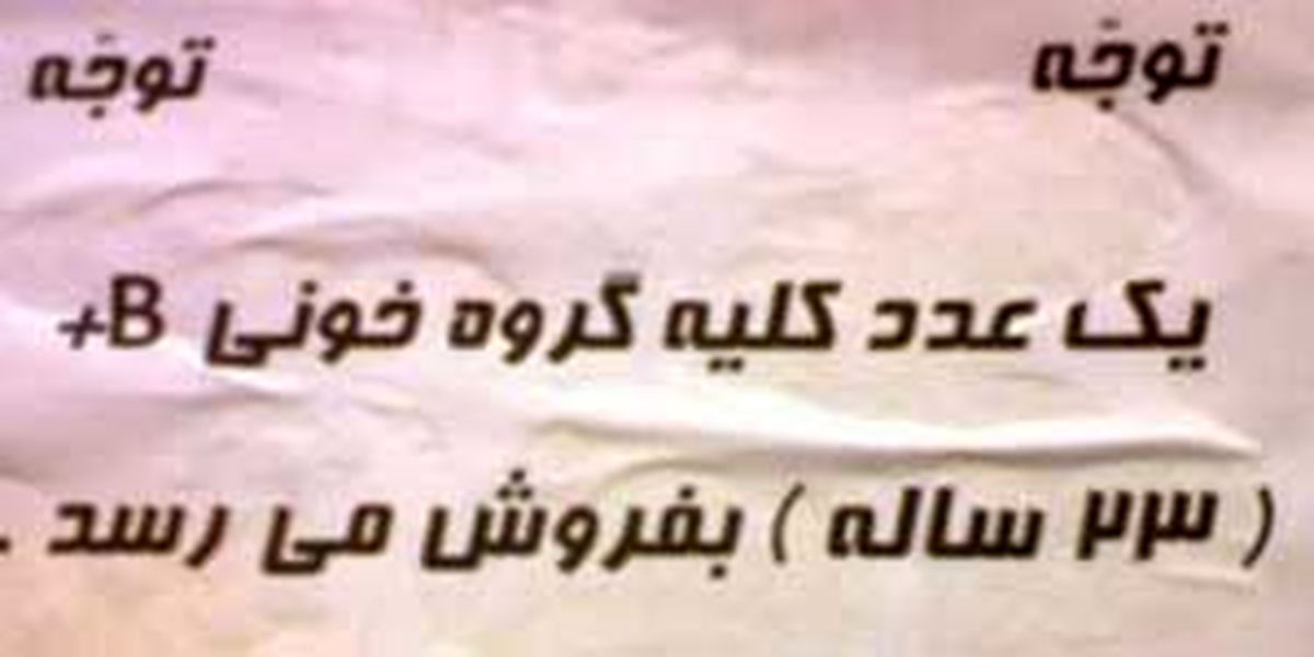 فروش کلیه چه حکمی دارد؟