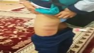 ماجرای تلخ تنبیه‌بدنی دانش‌آموز در مدرسه