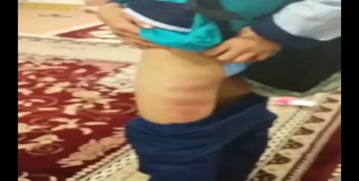 ماجرای تلخ تنبیه‌بدنی دانش‌آموز در مدرسه
