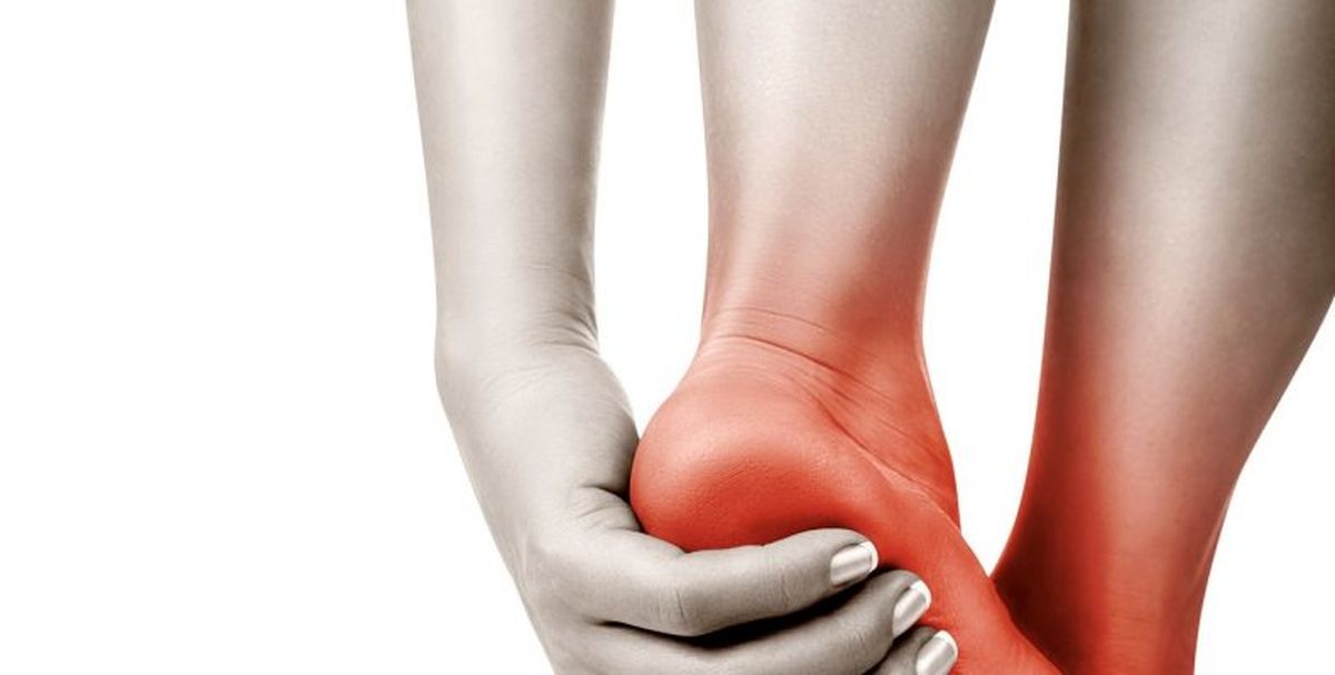 خار پاشنه را چگونه درمان کنیم؟
