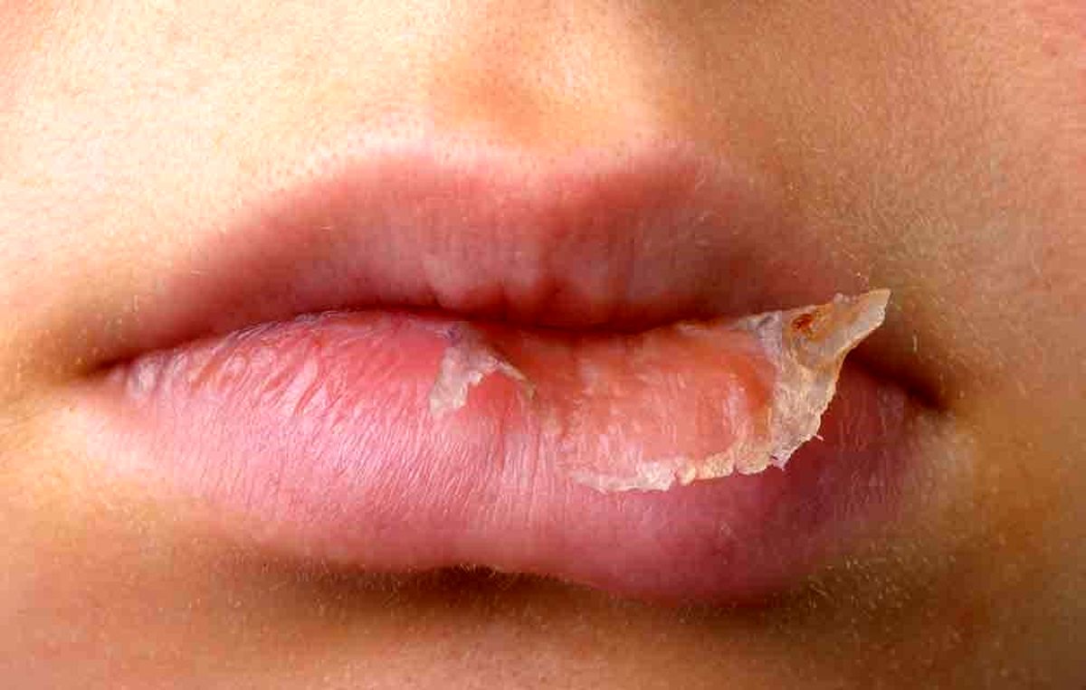 بالم لب چیست ؟