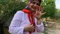 دستان سرخ خانم مجری مهربان دهه هفتاد!+عکس
