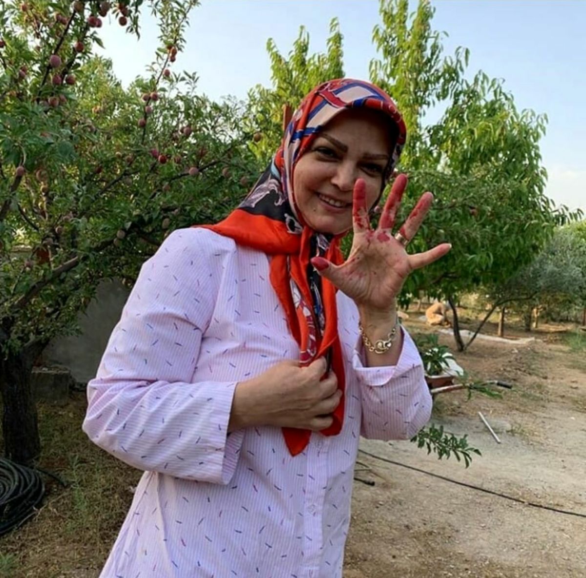 دستان سرخ خانم مجری مهربان دهه هفتاد!+عکس