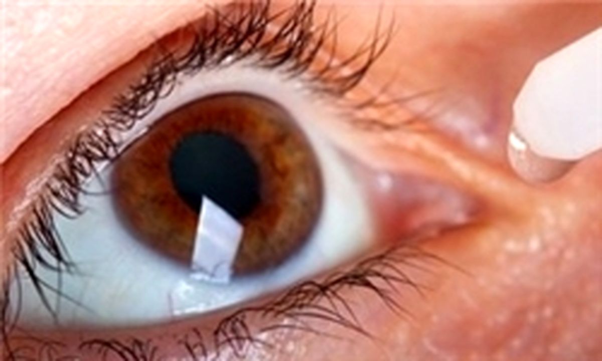 چند نکته کلیدی برای مراقبت از چشم