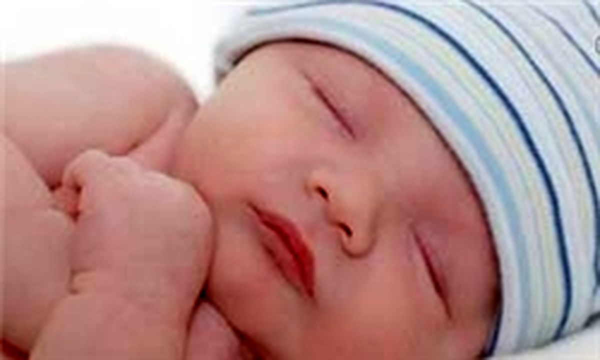 گرم نگه داشتن نوزاد باعث تشدید زردی می‌شود