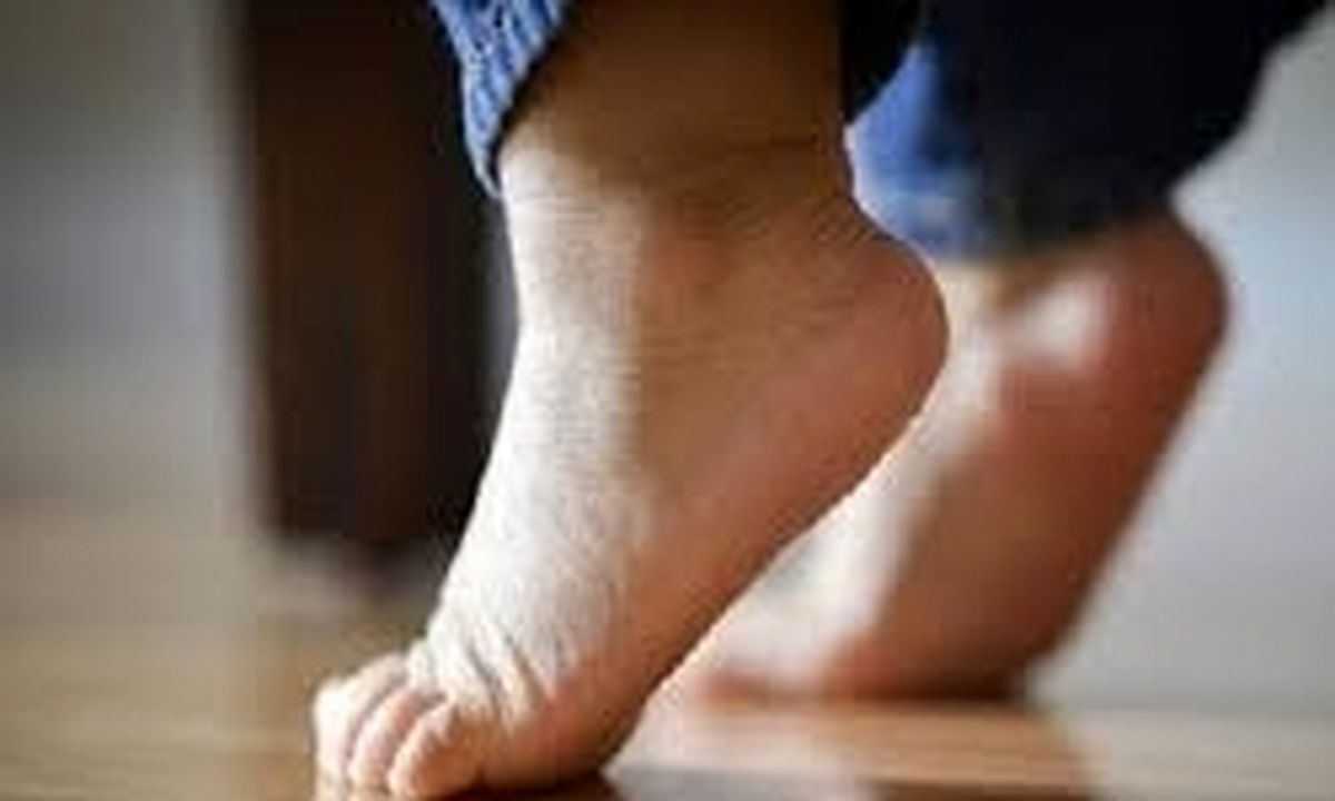چرا برخی کودکان روی پنجه پا راه می‌روند؟