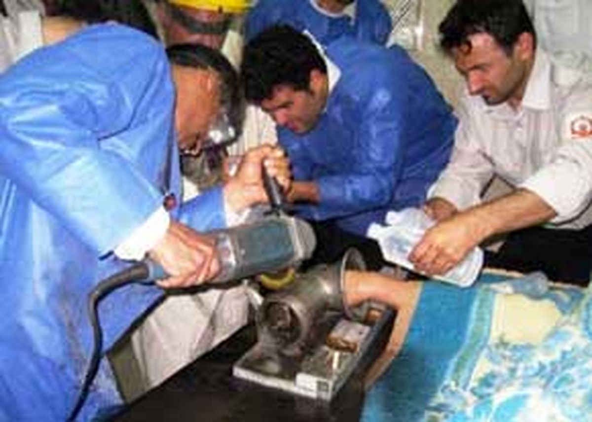 چرخ گوشت دست کارگر رستوران را بلعید 