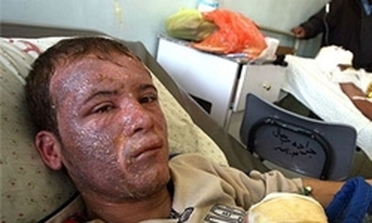 هزینه هر درصد سوختگی بدن چقدر است؟ 